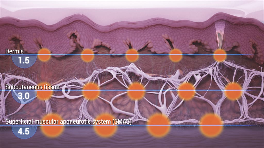Cross Section Skin