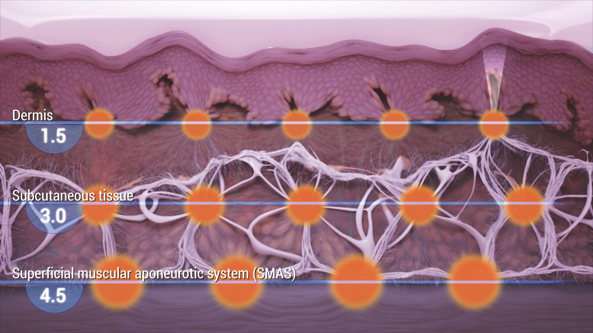 Cross Section Skin